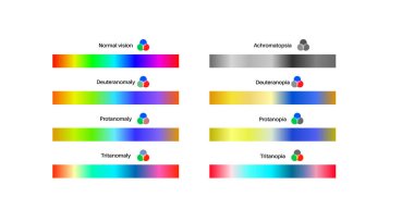 Color blindness infographic. Vision deficiency concept. Difference between colors. Deuteranomaly deuteranopia and protanomaly. Protanopia, tritanopia and tritanomaly. Achromatopsia vector illustration clipart