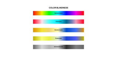 Renk körlüğü bilgisi. Görüş eksikliği konsepti. Renkler arasındaki fark. Deuteranomali Deuteranopia ve protanomali. Protanopia, tritanopia ve tritanomaly. Akromatopsi vektör illüstrasyonu