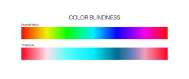 Tritanopia görüşü, renk körlüğü bilgisi. İnsan görüşü eksikliği konsepti. Renkler, parlaklık ve gölgelerin yoğunluğu arasındaki fark. Göz anormalliği düz vektör çizimi