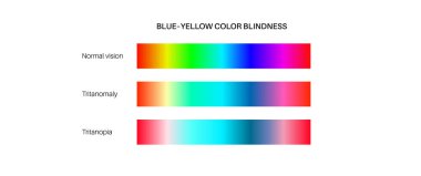 Renk körlüğü bilgisi. İnsan görüşü eksikliği konsepti. Renkler, parlaklık ve gölgelerin yoğunluğu arasındaki fark. Tritanopia, tritanomaly ve normal görme düz vektör çizimi