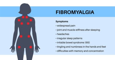 Kadın vücudunda fibromiyalji. Eklem kaslarında, yorgunlukta ve bilişsel semptomlarda kronik yaygın ağrı. Kas iskeleti hastalığı. Kadın siluetinde kırmızı noktalar tıbbi düz vektör çizimi.
