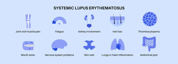 Systemischer Lupus Erythematodes Medizinisches Poster Schmetterlings Oder Malarenausschlag Auf Einem lizenzfreie Stockvektoren