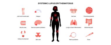 Systemic lupus erythematosus medical poster. Butterfly or malar rash on a female face. Autoimmune disease concept. Inflammation and skin tissue damage, pain in the internal organs vector illustration clipart