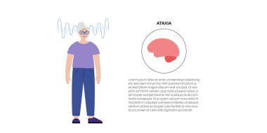 Cerebellar ataxia medical poster. Degenerative disease of the nervous system. Slurred speech, stumbling, falling, lack of coordination. Poor muscle control, clumsy movements flat vector illustration clipart