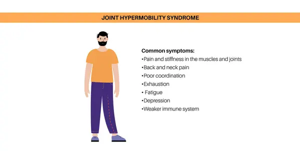 Síndrome Hipermobilidade Articular Distúrbio Espectro Hipermobilidade Grande Variedade Anormal Movimento Vetores De Stock Royalty-Free