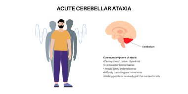 Cerebellar ataxia medical poster. Degenerative disease of the nervous system. Slurred speech, stumbling, falling, lack of coordination. Poor muscle control, clumsy movements flat vector illustration clipart