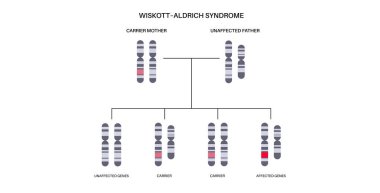 Wiskott Aldrich sendromu. X bağlantılı genetik bağışıklık yetmezliği. Erkeklerde bağışıklık sistemi hastalığı. Her ebeveynden mutasyona uğramış bir genin bir kopyası çocuğa miras kalır. Etkilenmiş, taşıyıcı ya da sağlıklı kromozomlar