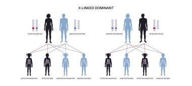 X linked dominant inheritance pattern. Child inherits one copy of a mutated gene from each parent. Genetic disease or disorder. Affected, carriers or healthy X and Y chromosomes vector illustration. clipart