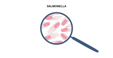 Salmonella bakteri posteri. İnsan vücudunda enfeksiyon. Büyüteç altındaki bağırsaklarda enfekte hücreler. Mide ve bağırsak ağrısı. Mide-bağırsak yolu hastalığı Tıbbi vektör çizimi