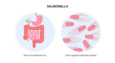 Salmonella bakterisi tıbbi afişi. İnsan vücudunda enfeksiyon. Mikrop kapmış hücreler mikroskop altında. Mide ve bağırsak ağrısı. Gastrointestinal kanal düz vektör çizimi hastalığı