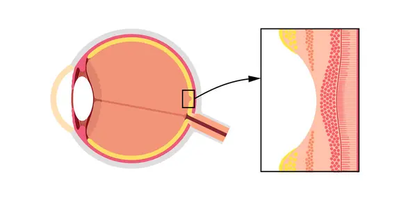 stock vector Macula fovea and foveola structure anatomy. Scheme of retina layer in the eye. Posterior portion of the eyeball. Photoreceptor, neuronal and glial cells, cones and rods diagram, vector illustration