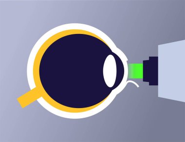 Lazer göz ameliyatı. Miyopluk, miyopluk, miyopluk ve astigmatizm gibi görüş sorunlarının düzeltilmesi. Acısız bir işlem korneayı, insan gözü anatomik düz vektör çizimini yeniden şekillendirir.