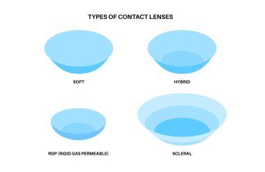 Contact lenses poster, ocular prosthesis, rigid gas permeable, soft or scleral types. Vision problem concept, cosmetic effect or treatment. Refraction error correction flat vector medical illustration clipart