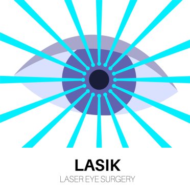 Lazer göz ameliyatı. Miyopluk, miyopluk, miyopluk ve astigmatizm gibi görüş sorunlarının düzeltilmesi. Acısız bir işlem korneayı, insan gözü anatomik düz vektör çizimini yeniden şekillendirir.