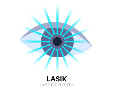 Lazer göz ameliyatı. Miyopluk, miyopluk, miyopluk ve astigmatizm gibi görüş sorunlarının düzeltilmesi. Acısız bir işlem korneayı, insan gözü anatomik düz vektör çizimini yeniden şekillendirir.
