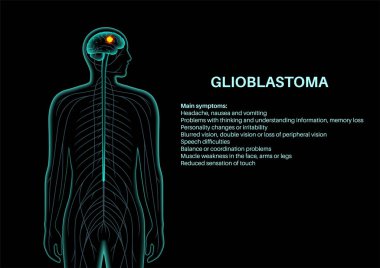 Glioblastoma tumor poster, cancer in the brain or spinal cord. Headache, nausea, seizures and vomiting symptoms. Damaged cells astrocytes that support nerve cells medical 3D vector illustration clipart