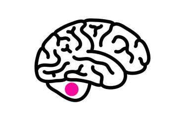 Medulloblastoma medical icon. Cancerous brain tumor in children. Cerebellum disease concept. Neoplasm in the child or infant. Problem with balance, coordination, and optic nerve vector illustration clipart