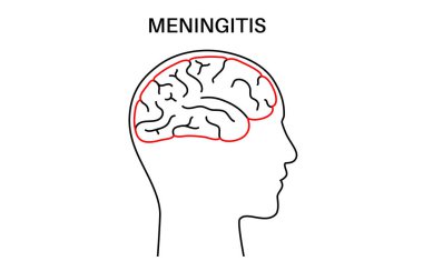 Beyni ve omuriliği çevreleyen koruyucu tabakalarda menenjit iltihabı. Meninges hastalığı logosu ya da ikonu. Bakteriler, virüsler, mantarlar, parazitler insan kafası düz vektör illüstrasyonunda