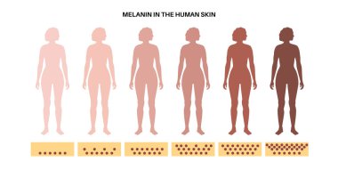 İnsan derisinde Melanin. Kadın vücudunda ışıktan koyu renk pigmentasyona kadar dereceler var. Zararlı ultraviyole ışınları emmek, ciltteki hücreleri korumak ve üst deriyi güneş hasarlı düz vektör çizimlerinden korumak.