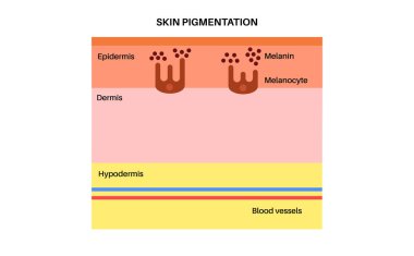 İnsan derisi anatomik posterinde Melanin. Melanositler deri pigmentasyonu üretir. Zararlı ultraviyole ışınları emmek, ciltteki hücreleri korumak ve üst deriyi güneş hasarlı düz vektör çizimlerinden korumak.