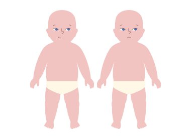 Biri gülümseyen, diğeri de üzgün ya da hasta görünen iki bebek. Çocukluğunda beyaz arka planda sağlık ve hastalıklı çocuklar arasındaki karşıtlığı gösteren pediatrik siluet vektörü.