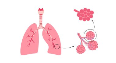 Akciğerler tıbbi afiş. İnsan vücudunda solunum, gaz değişimi ve oksijen alımı. Solunum sistemini soluk borusu, bronşlar, alveoller ve bronşlar ile anatomik düz vektör çizimi ile özelleştirir.