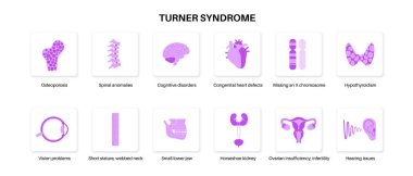 Turner sendromu semptomları, kusurlu organlar ve gen anomalileri ikonları. Kısa boylu, perdeli boyun, kalp ve yumurtalık bozuklukları, hormon dengesizliği. Pediatrik bozukluk diyagramı vektör tıbbi çizimi