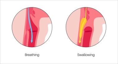 Nefes alırken ve yutkunurken kafa ve boyun anatomisi. Oklar nefes borusundan geçen hava akımını ve yemek borusundan geçen besinleri gösteriyor. Epiglottis konumu tıbbi düz vektör diyagramını değiştirir
