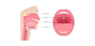 Adenoid tıbbi poster, farengeal bademcik, boğazın üst kısmında, burnun arkasında bulunan lenfoid doku yığını. Bağışıklık sistemi konsepti. Çocuklar sağlık tıbbi düz vektör çizimi.
