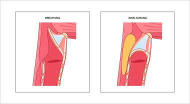 Nefes alırken ve yutkunurken baş ve boynun yan görüntüsü. Soluk borusundan hava geçerken ve yemek yemek borusuna girerken, epiglotlar solunum yolu tıbbi vektörünü kapatır.