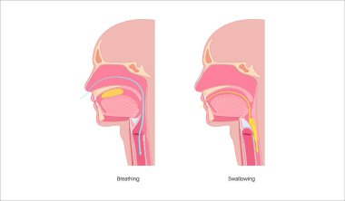 Nefes alırken ve yutkunurken kafa ve boyun anatomisi. Oklar nefes borusundan geçen hava akımını ve yemek borusundan geçen besinleri gösteriyor. Epiglottis konumu tıbbi düz vektör diyagramını değiştirir