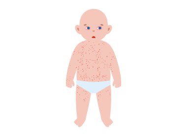 Çocuklarda görülen en yaygın isilik. Çoklu çocuk siluetleri, gövde, yüz, kol ve bacaklarda her hastalık için döküntü desenler var. Kızamık, rubeola, rubella, roseola. Çeşitli aşamalarda Vesiküler lezyonlar