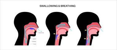 Nefes alırken ve yutkunurken kafa ve boyun anatomisi. Oklar nefes borusundan geçen hava akımını ve yemek borusundan geçen besinleri gösteriyor. Epiglottis konumu tıbbi düz vektör diyagramını değiştirir