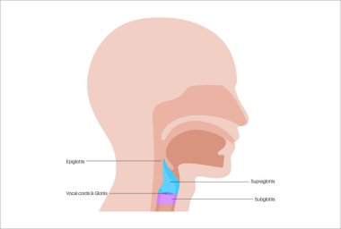 Gırtlak anatomisi sagittal görüşde. Ses telleri, epiglot, tiroit kıkırdağı, krikoid kıkırdağı. Nefes borusu ve etrafındaki dokular. Ses üretimi ve hava yolu korumasını anlamak için tıbbi vektör