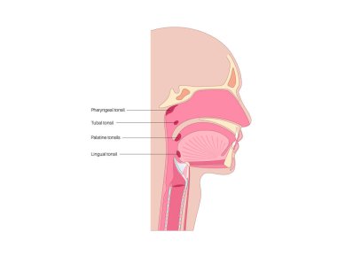 Adenoid tıbbi poster, farengeal bademcik, boğazın üst kısmında, burnun arkasında bulunan lenfoid doku yığını. Bağışıklık sistemi konsepti. Çocuklar sağlık tıbbi düz vektör çizimi.