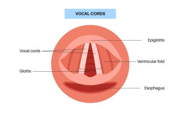 Ses telleri tıbbi afiş. Gırtlak anatomisi, gırtlak iltihabı, hava akışı ve ses çıkarma. ENT konsepti, otolaringoloji ve konuşma terapisi. Teşhis, stroboskopi ve solunum tıbbı vektörü cerrahi eğitimi