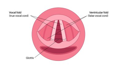 Ses telleri tıbbi afiş. Gırtlak anatomisi, gırtlak iltihabı, hava akışı ve ses çıkarma. ENT konsepti, otolaringoloji ve konuşma terapisi. Teşhis, stroboskopi ve solunum tıbbı vektörü cerrahi eğitimi