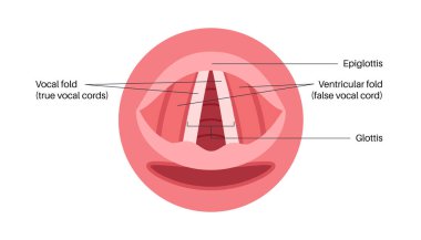 Ses telleri tıbbi afiş. Gırtlak anatomisi, gırtlak iltihabı, hava akışı ve ses çıkarma. ENT konsepti, otolaringoloji ve konuşma terapisi. Teşhis, stroboskopi ve solunum tıbbı vektörü cerrahi eğitimi