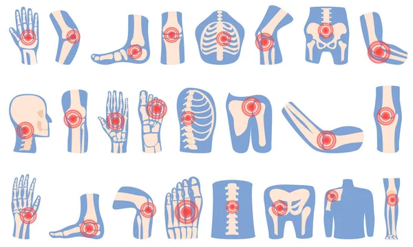 stock vector Arthritis icons set cartoon vector. Joint injury. Medical science