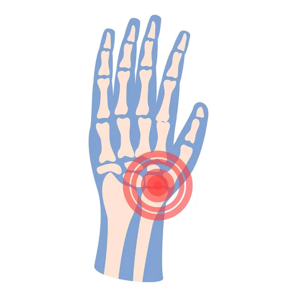 Hand Artrit Ikon Tecknad Vektor Ledvärk Medicinsk Patient — Stock vektor