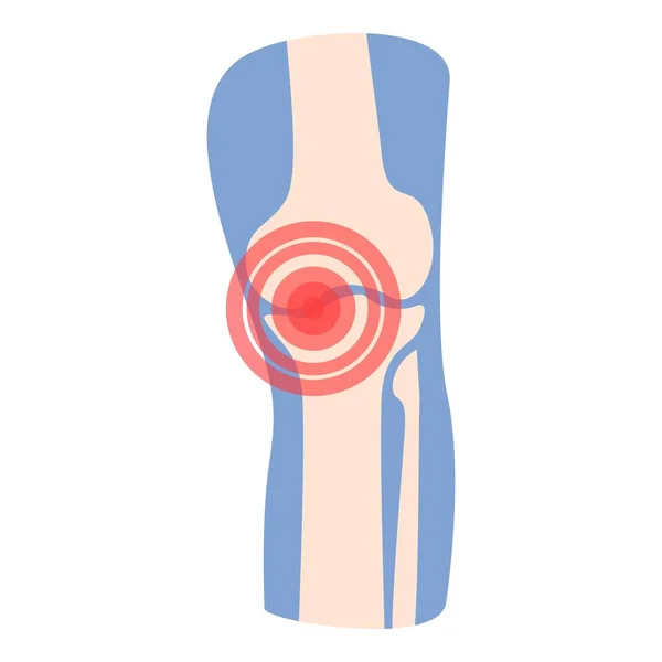 Ασθενής Πόδι Εικονίδιο Φορέα Κινουμένων Σχεδίων Αρθρίτιδα Θεραπεία Πόνου — Διανυσματικό Αρχείο