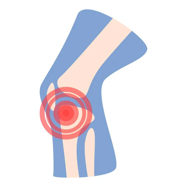 Articolazione Icona Vettore Cartone Animato Artrite Articolare Trattamento Medico — Vettoriale Stock