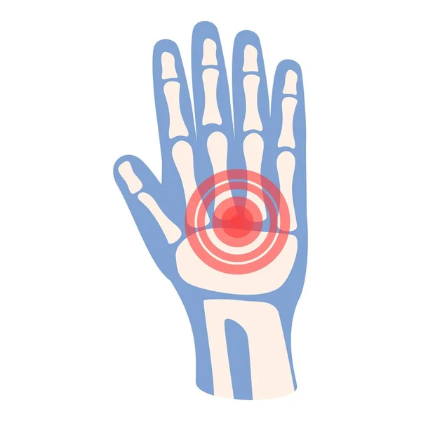 Hand Smärta Ikon Tecknad Vektor Medicinsk Behandling Artrit Gemensamma — Stock vektor