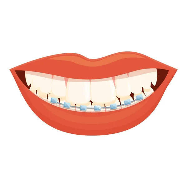 Жінка Губи Посміхається Значок Мультфільму Вектор Зубний Камінь Стоматологічна Допомога — стоковий вектор