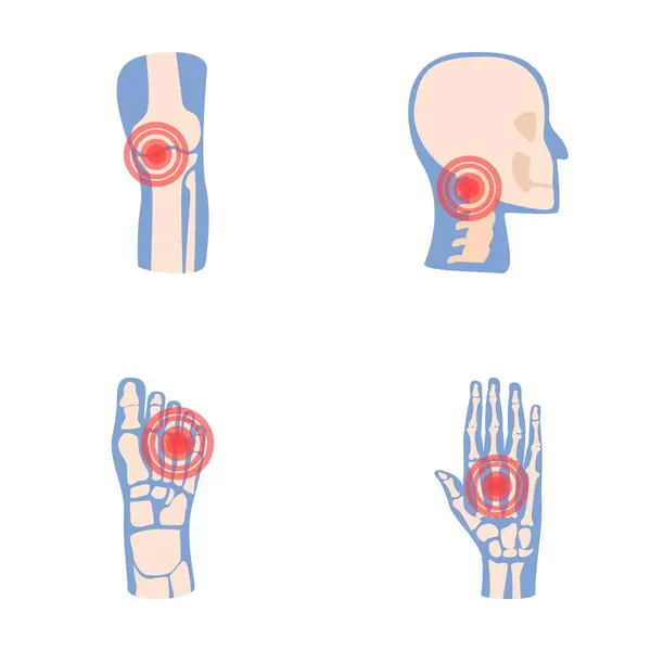 stock vector Joint disease icons set cartoon vector. Human joint with red pain ring. Rheumatology, medicine