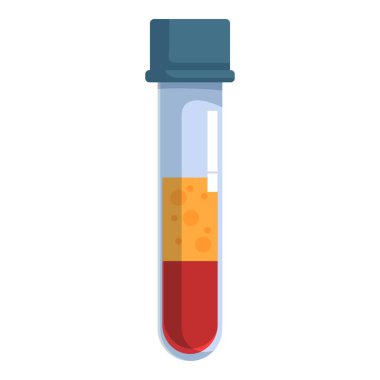 Ayrılmış kan örneği içeren test tüpü bir tıp laboratuarında analiz ediliyor.