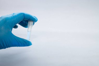 Bir laboratuvar çalışanı analiz için test tüpü gösteriyor..