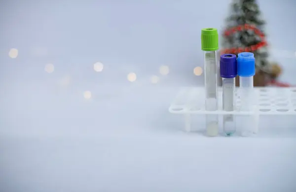 Vacuum blood collection tube with sodium citrate in stand. Test tubes with blurred christmas tree and lights in background