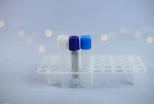 Vacuum blood collection tube with sodium citrate in blue gloves for laboratory. Test tubes with blurred christmas lights in background