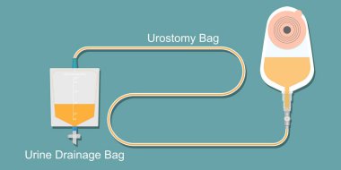 İdrar torbası ve idrar torbası..